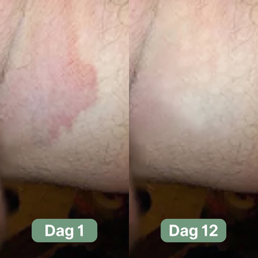 Nordic SkinBalance™ Danmark – Dybderensende kropsbar til svedudsatte hudområder