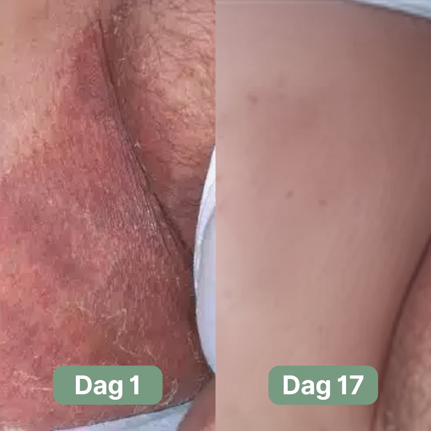 Nordic SkinBalance™ Danmark – Dybderensende kropsbar til svedudsatte hudområder