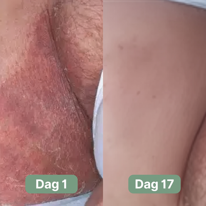 Nordic SkinBalance™ Danmark – Dybderensende kropsbar til svedudsatte hudområder